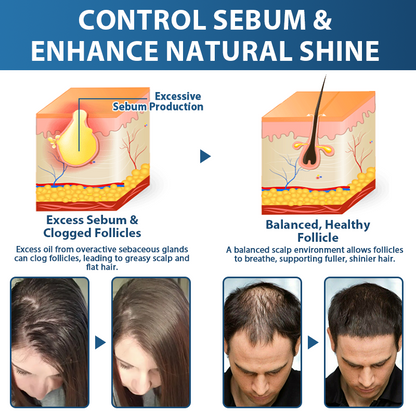 ✅🇺🇸 Developed by Trichologists：High-Concentration Minoxidil Hair Regrowth Serum