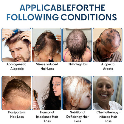 ✅🇺🇸 Developed by Trichologists：High-Concentration Minoxidil Hair Regrowth Serum