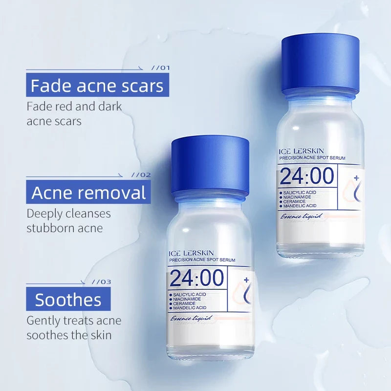 Acne Drying Lotion – Fights Inflamed & Pus-Filled Pimples Fast