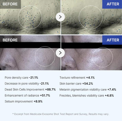 Exosome Micro-Needle Serum